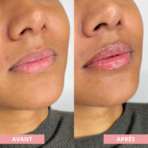 Kit Ritual Lips
