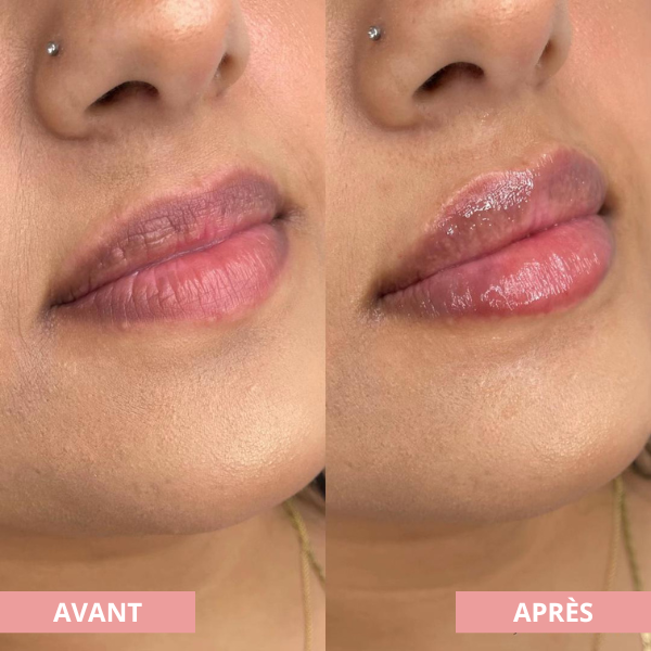 Kit Ritual Lips