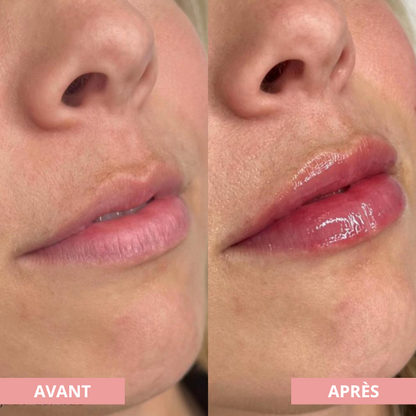 Kit Ritual Lips
